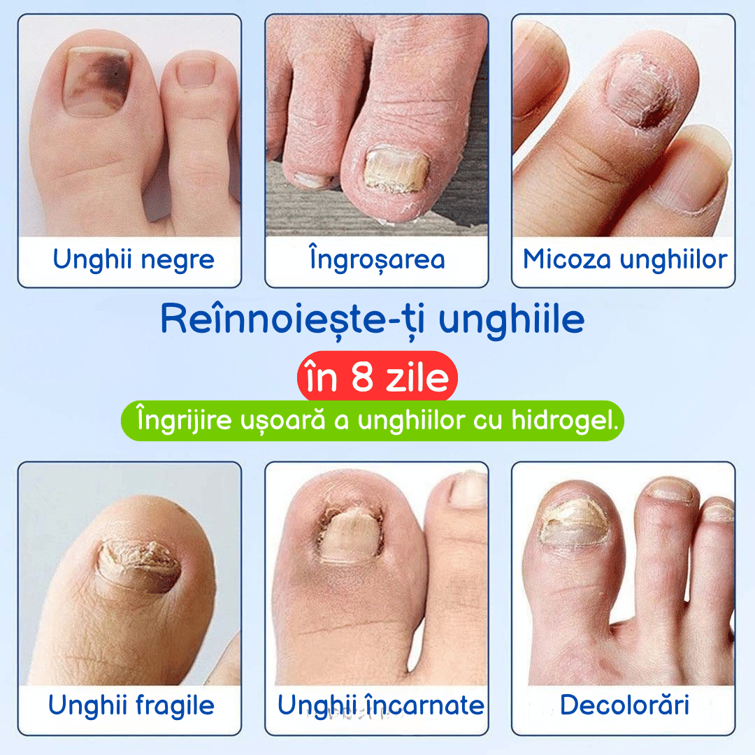 Plasture antibacterian