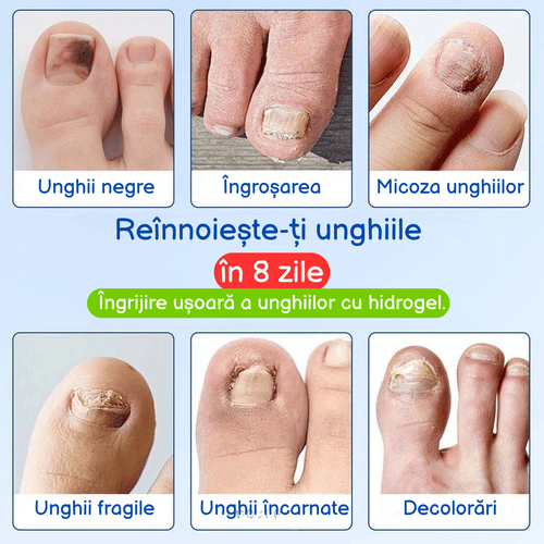 Plasture antibacterian